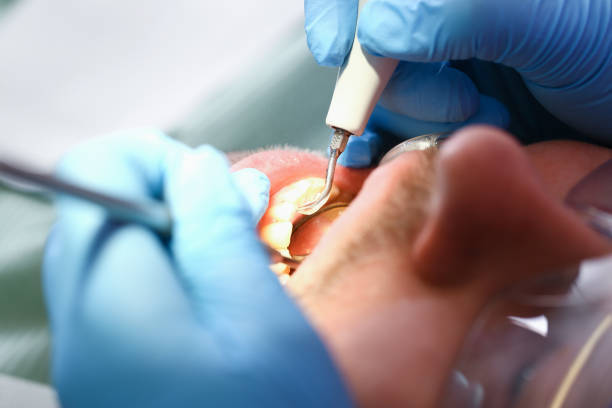 Best Pediatric Emergency Dentist in Oronoco, MN