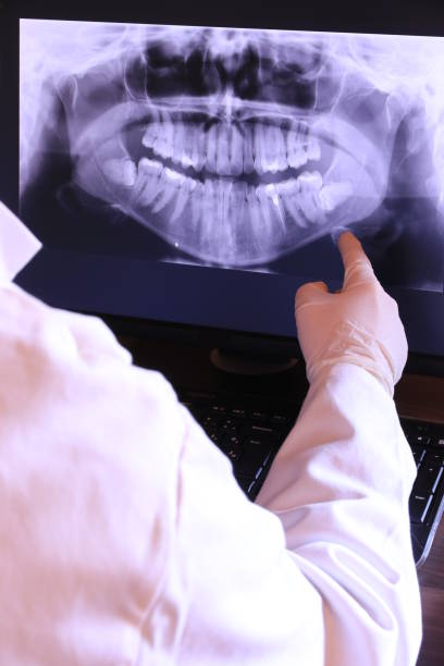 Best Emergency Denture Repair in Oronoco, MN
